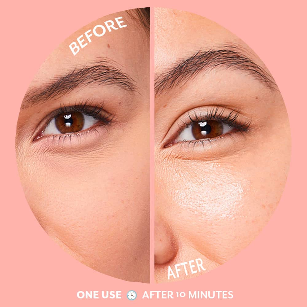 Bubbly Eye Gels- 5 Pairs/ Box